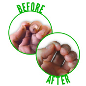 before-after.jpg